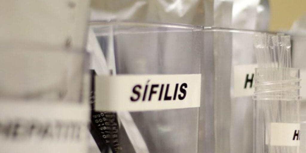 SUS amplia uso de antibiótico para prevenir sífilis e clamídia: o que você precisa saber SUS amplia uso de antibiótico para prevenir sífilis e clamídia: o que você precisa saber