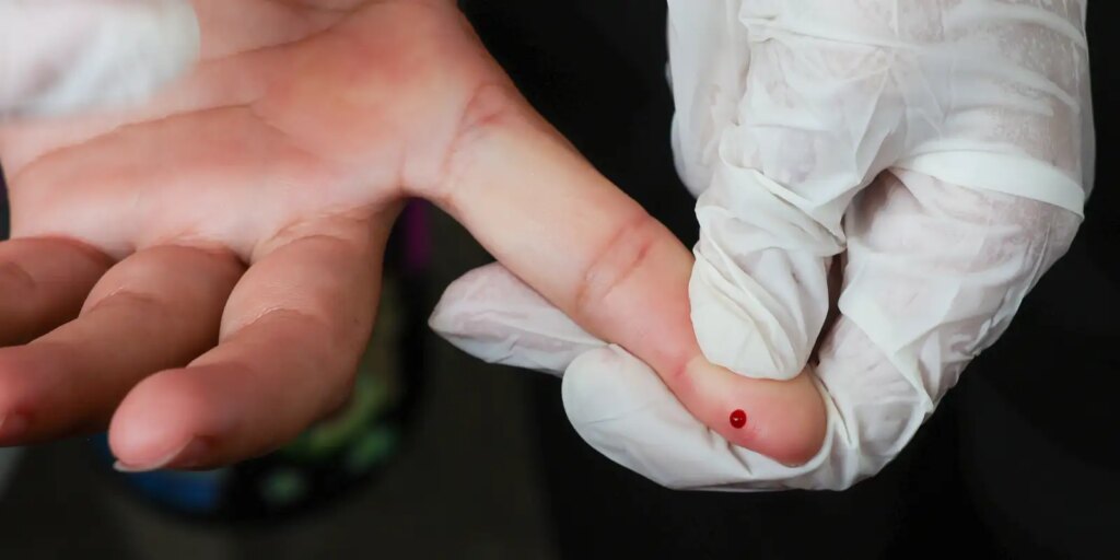 Teste Rápido de Dengue: SUS Amplia Acesso ao Diagnóstico Precoce Teste Rápido de Dengue: SUS Amplia Acesso ao Diagnóstico Precoce