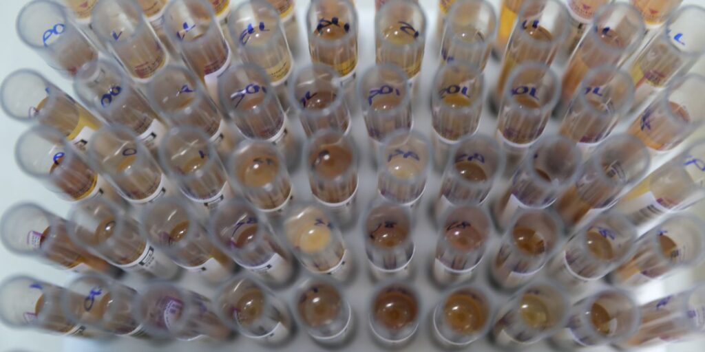 Novo medicamento no SUS contribui para a queda expressiva de casos de malária no Brasil 53648101607_05fbb4f626_o